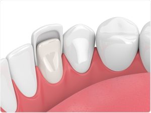 Dental Health and Pregnancy: A Critical Connection