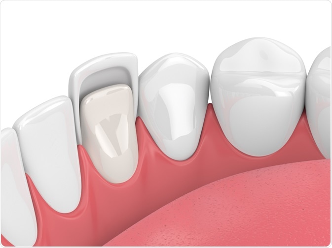 Dental Health and Pregnancy: A Critical Connection
